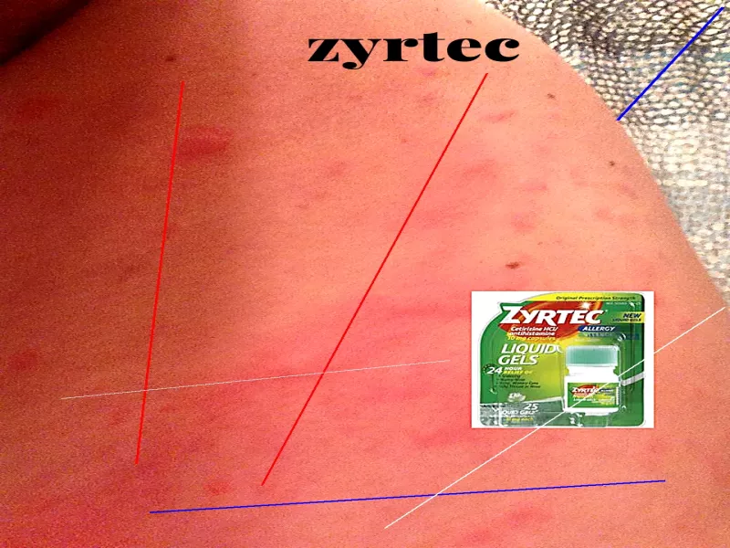 Prix du zyrtec en france